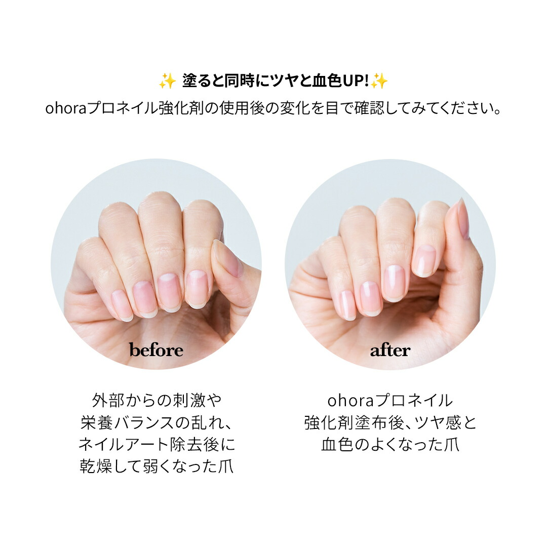 楽天市場】【公式】フルケアセット：SET-016 ohora gelnails nail