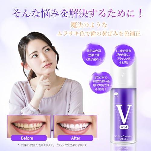 楽天市場】ホワイトニング V34 歯磨き 歯を白く ホワイトニングジェル