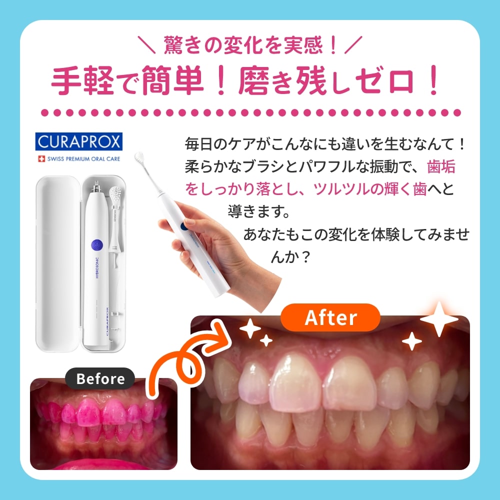 楽天市場】【送料無料】CURAPROX クラプロックス 音波式電動歯ブラシ