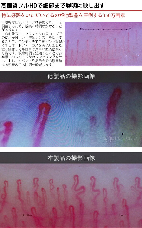 楽天市場】顕微鏡 血流スコープ 肌 血流観察 チェック 確認 検査 頭皮