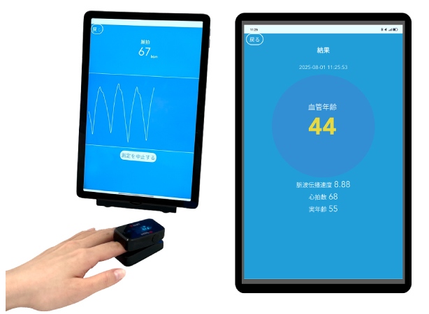 血管年齢測定器 iheart