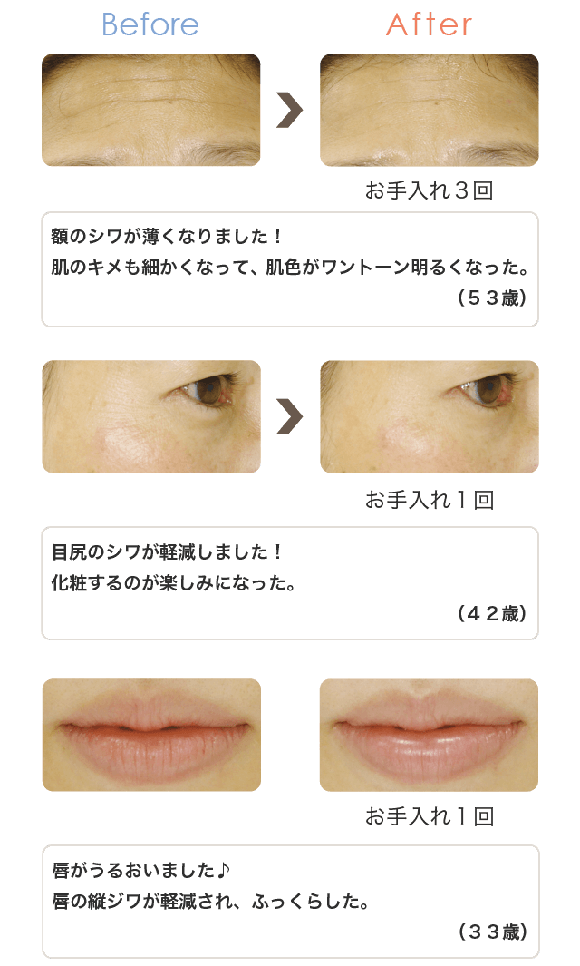 ハリ！弾力！リフトアップに！クロロフイルのエイジングケア