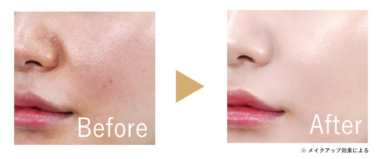 SPICULE FOUNDATION ｜ クララベルス（Clarabells）【公式サイト】