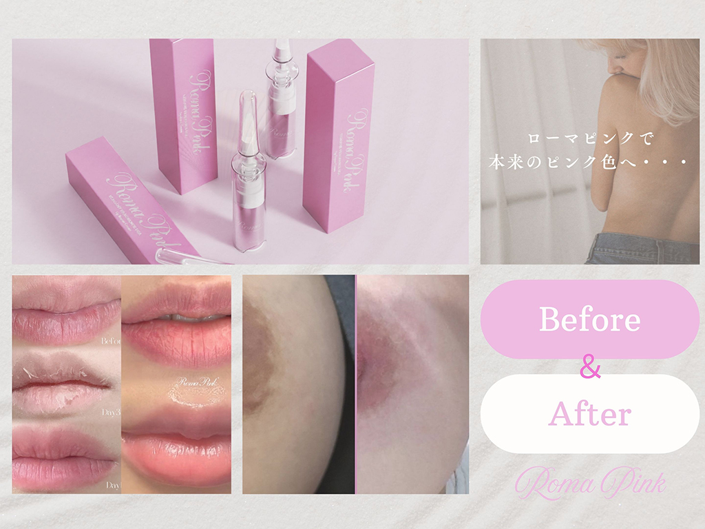 ローマピンク