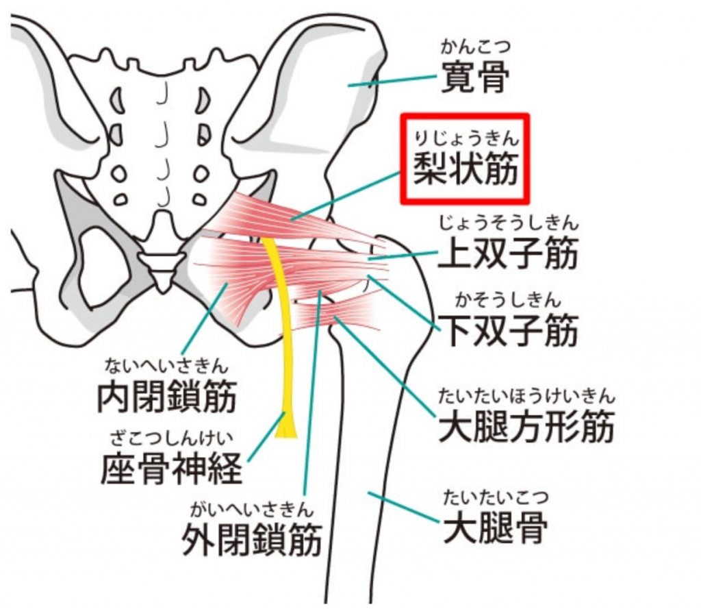腰痛と坐骨神経痛のダブルパンチで歩行困難になった女性、今ではジムに