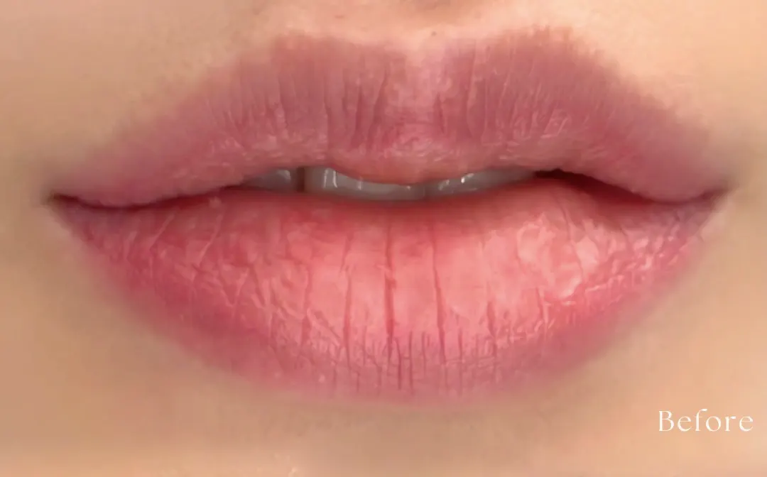 Roma Pink-ローマピンク- | フェイシャル【エステサロンKAREN（カレン）】