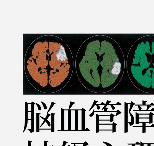 脳血管障害と神経心理学 2E』 立ち読み
