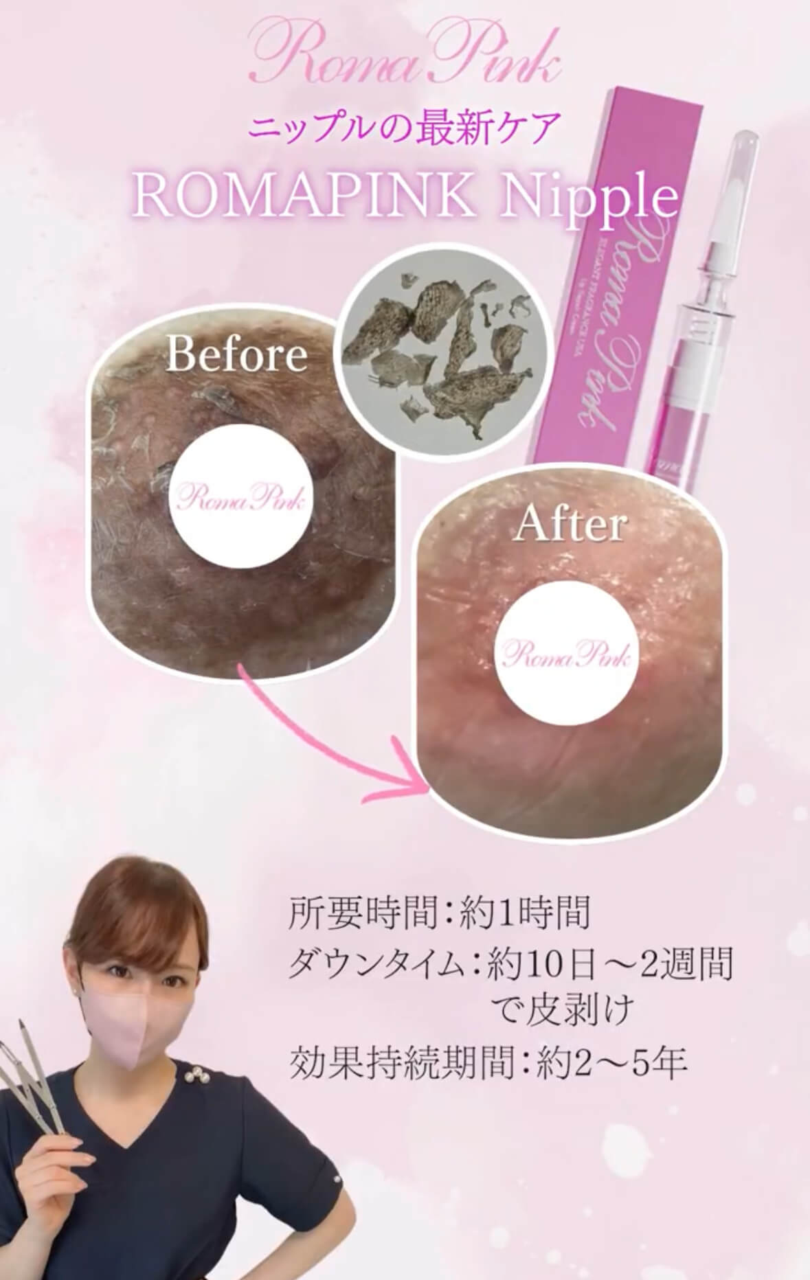 ROMA PINK｜“地肌トーンをやさしく底上げ”するメラニンケア【ローマ