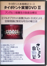 本格実習編【本格コースDVD】 << 各種タイポドント矯正DVD << 矯正教材