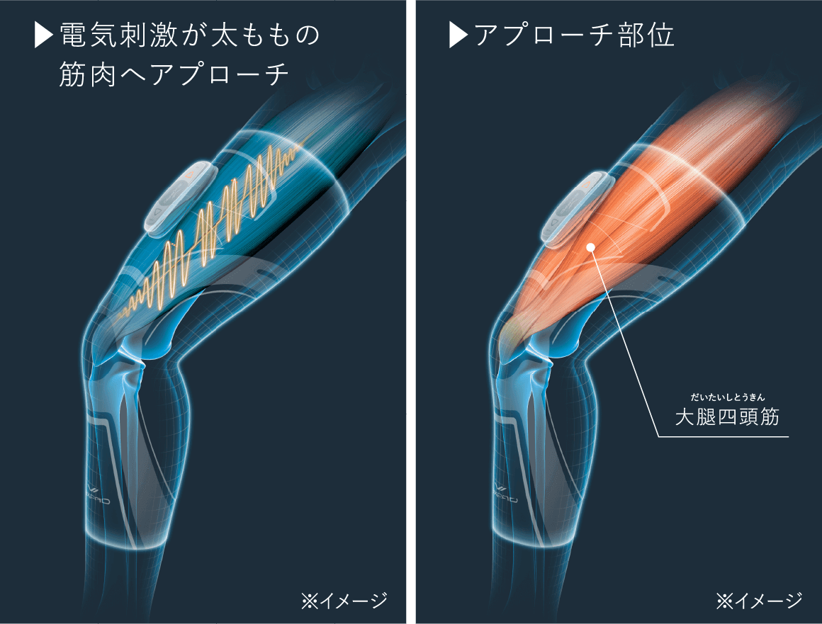 シックスパッド ニーフィット(Kneel Fit) ひざにつながる太ももの筋肉