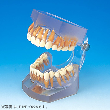 透明レジン製不正咬合模型 [P12P-O各種](P咬合器つき)｜株式会社