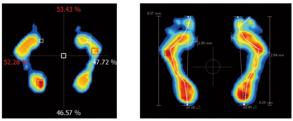 足底圧センサー Foot Checker | 商品情報 | 国際姿勢協会