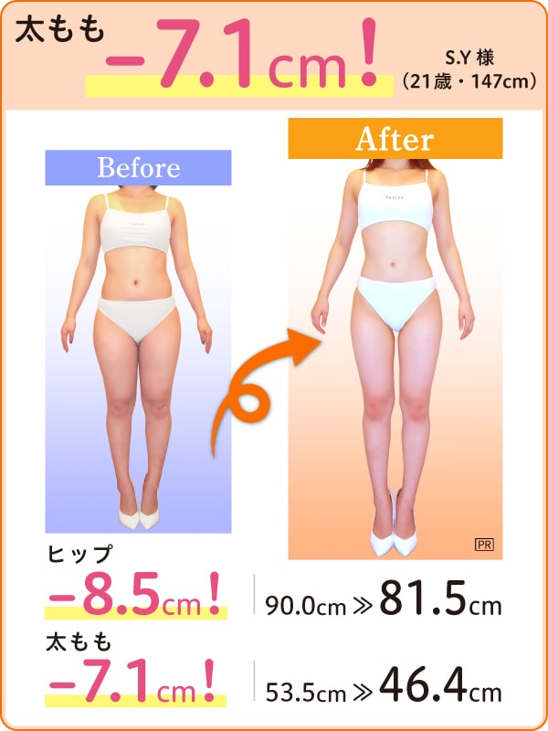 汗だくセルライトproコースとエステ体験の紹介｜痩身・脚やせならラ