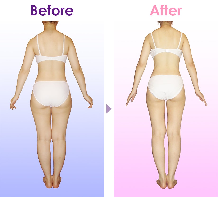 ラ・パルレ エステの口コミ・体験談｜脚やせ・痩身・ブライダル