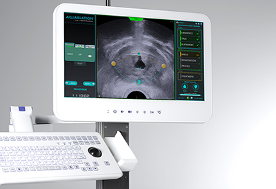 PROCEPT BioRobotics raises $85M Series G for surgical robots