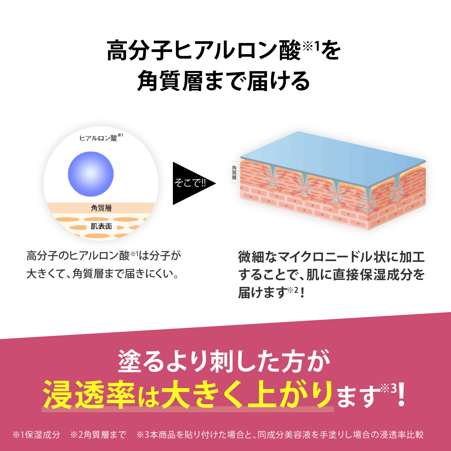 メディリフト 3Dマイクロフィラー4袋セット｜ヤーマン公式通販サイト