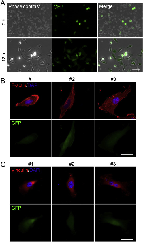 Suspension state increases reattachment of breast cancer cells by