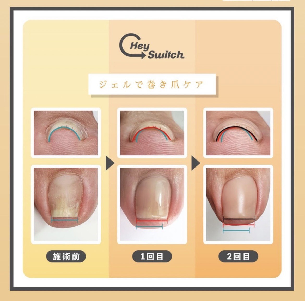 Hey Switchジェル | Be creation NAIL ACADEMY