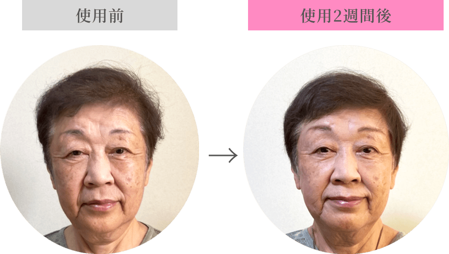 バイオメドテックショップ｜バイオファクター エクソソームヘア
