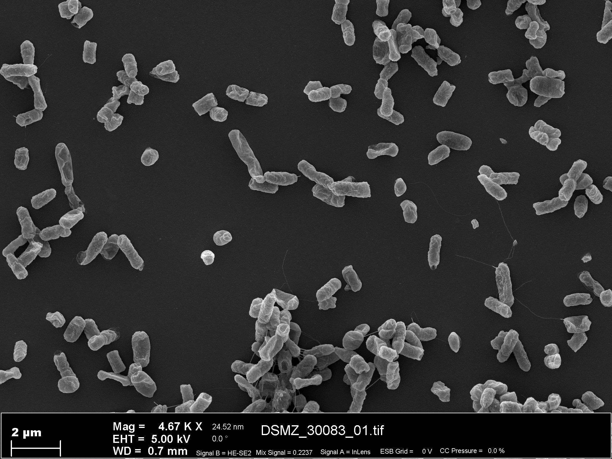 Escherichia coli U5/41, U 5/41 | Type strain | DSM 30083, ATCC