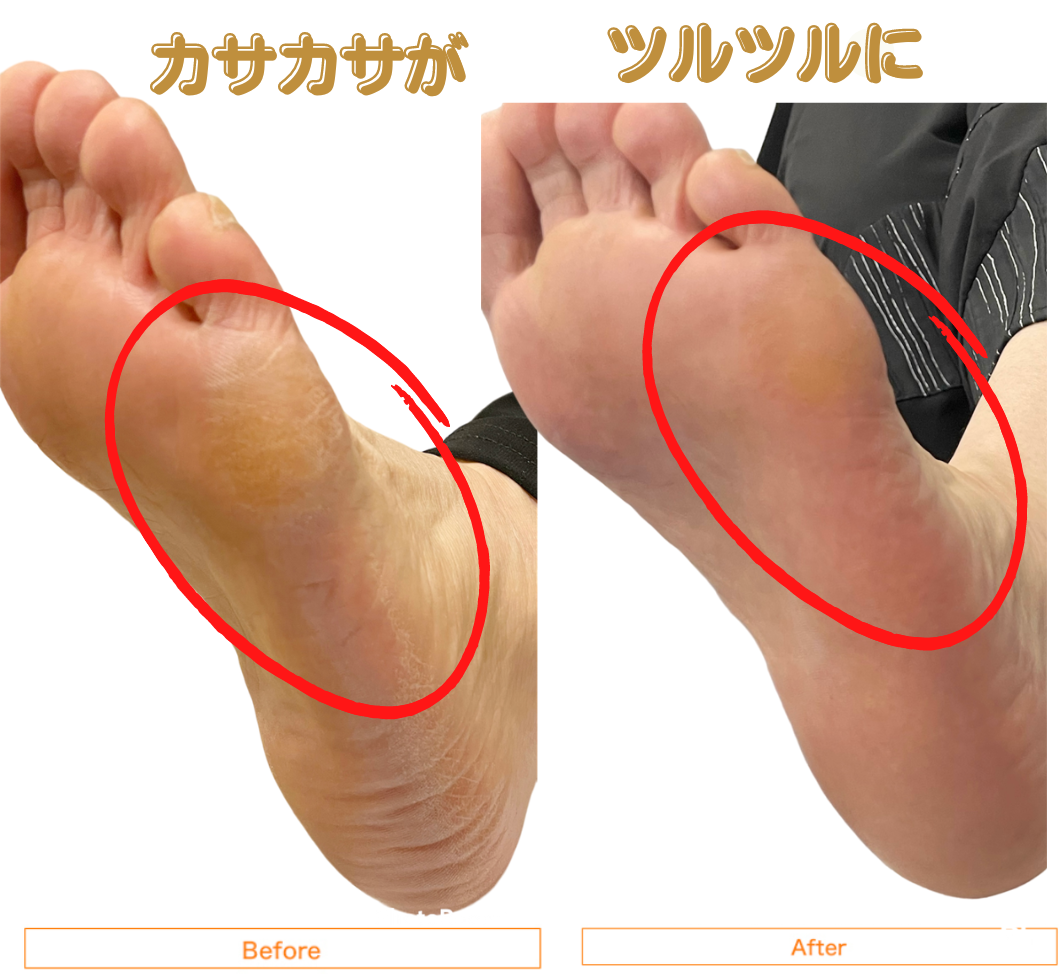 足指ほぐし三兄弟