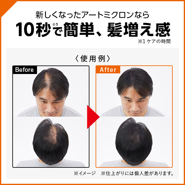 カバー&育毛セットの通販｜アートネイチャー・オンラインショップ