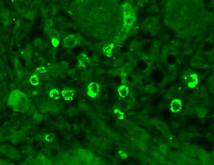 Anti-GABA A Receptor alpha 1 antibody [N95/35] (ab94585) | Abcam