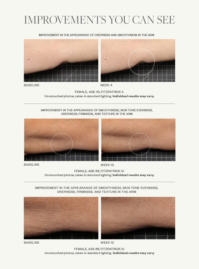 SkinMedica Firm & Tone Body Lotion | DermWarehouse
