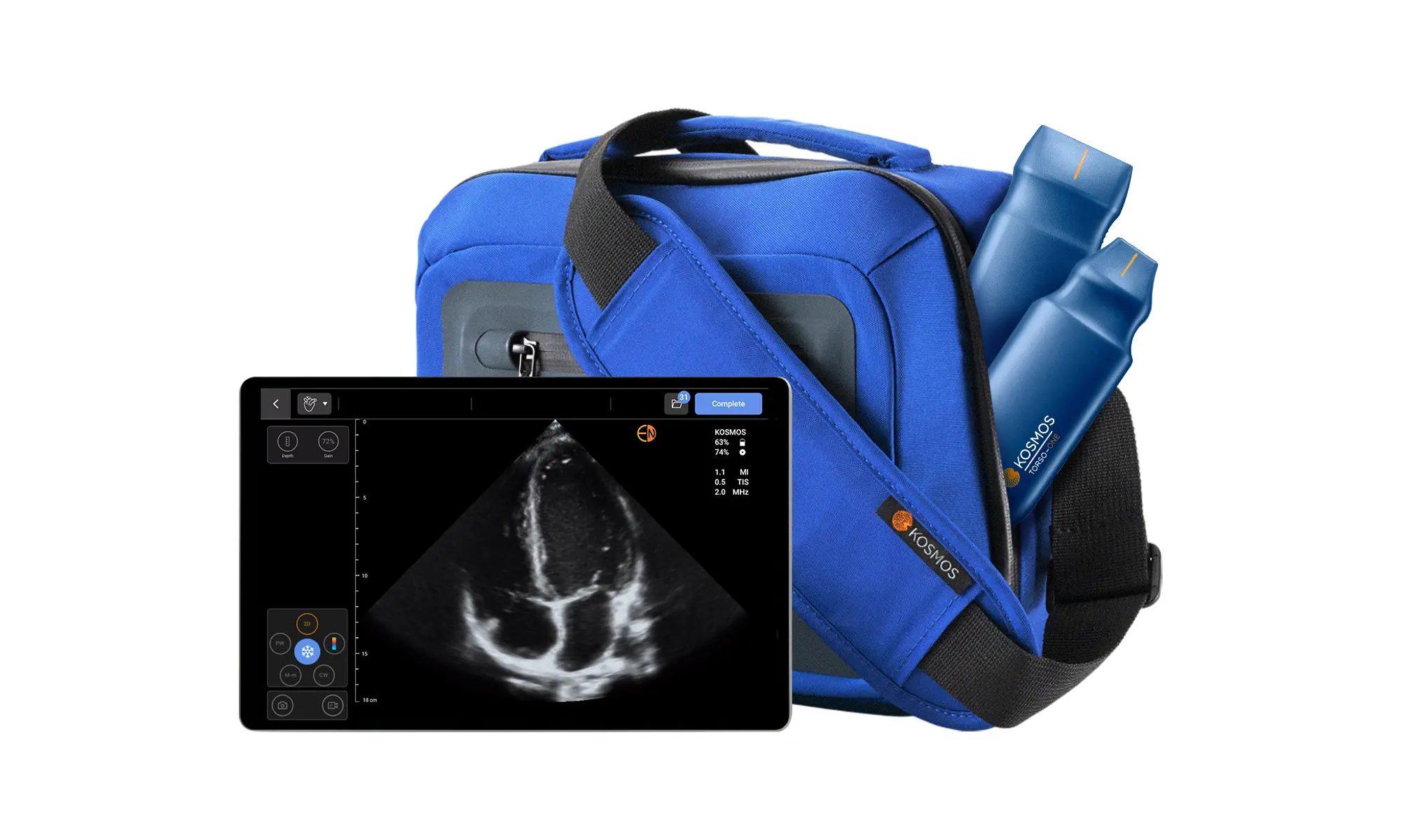 Affordable POCUS On The Go | Kosmos Mobile