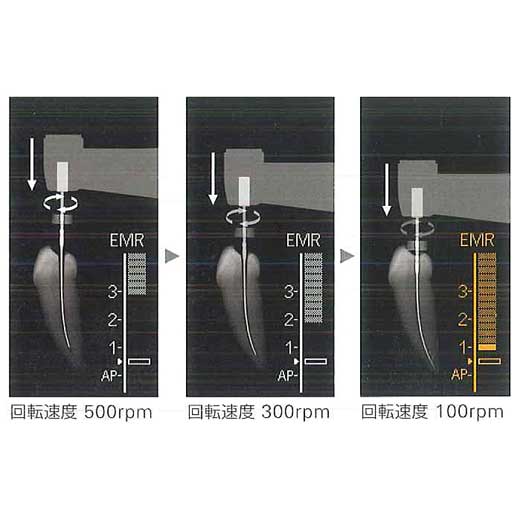 製品詳細「トライオートZX2＋」 | フォルディネット