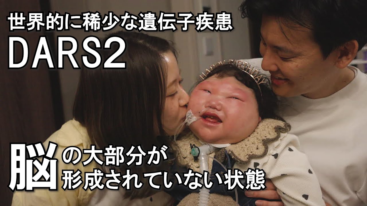 稀少すぎる遺伝子疾患】脳にしわがない娘をケアする夫婦の葛藤