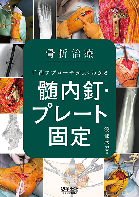 m3電子書籍 | 骨折・脱臼 改訂5版