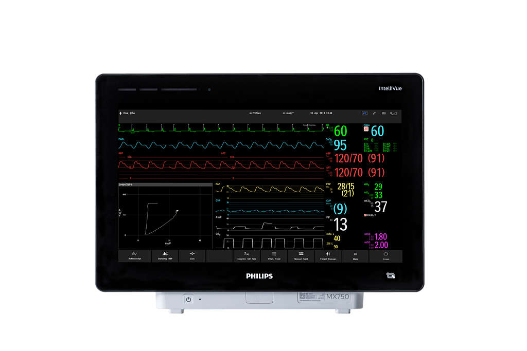 IntelliVue AD75 Active Display | Philips - Philips