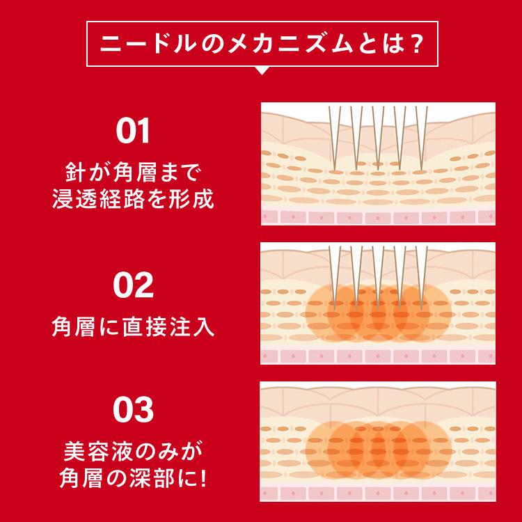 CONC（コンク） 【公式】【10%OFF】CONC リンクルインジェクション 2.5