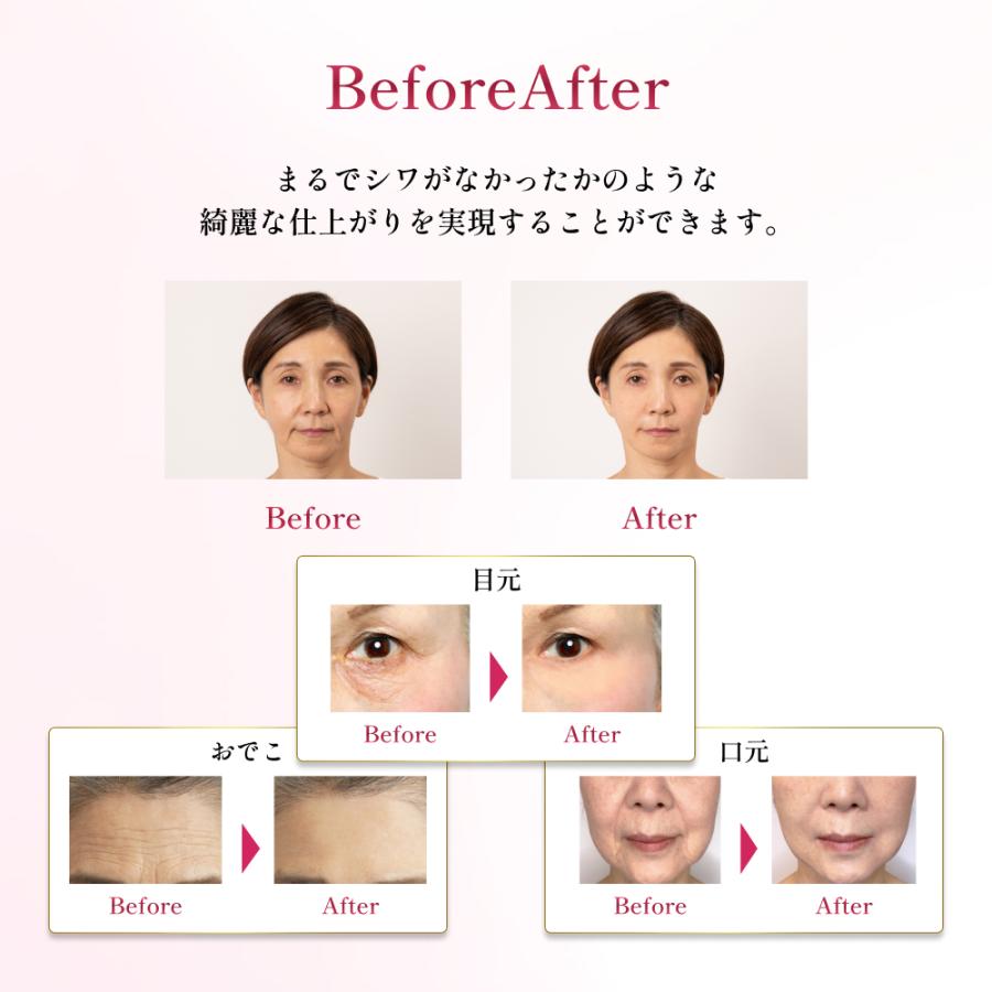 2個セット) ビューティーセカンズ プロ BEAUTY SECONDS PRO