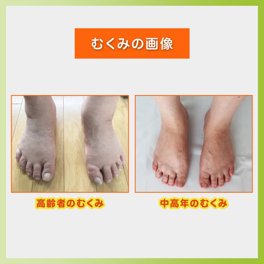 むくみ 足 グーパー体操スッキリ 高齢者靴下 浮腫 解消器具 足の甲