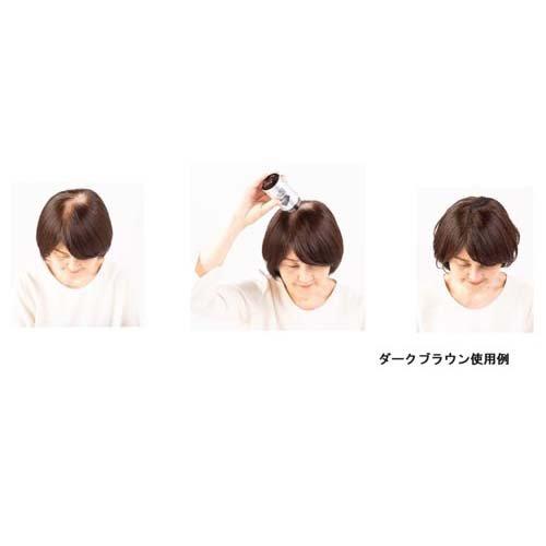 スーパーミリオンヘアー ミストセット ダークブラウン ( 1セット