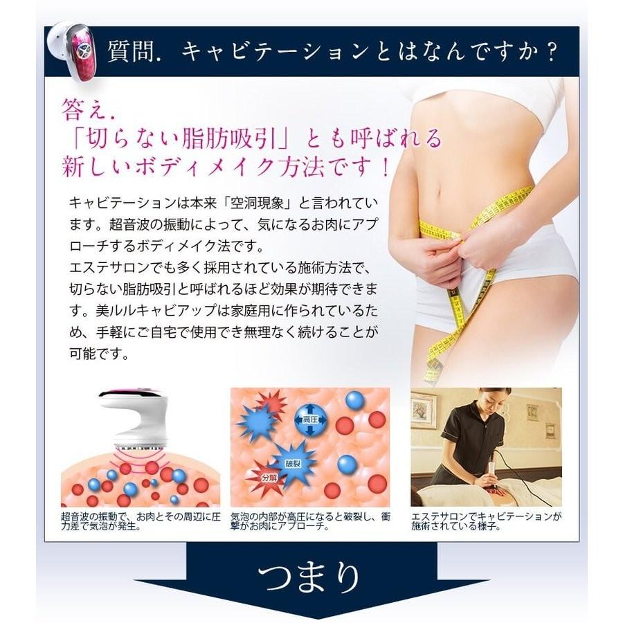キャビテーション 家庭用 セルライト 除去 美ルル キャビアップ