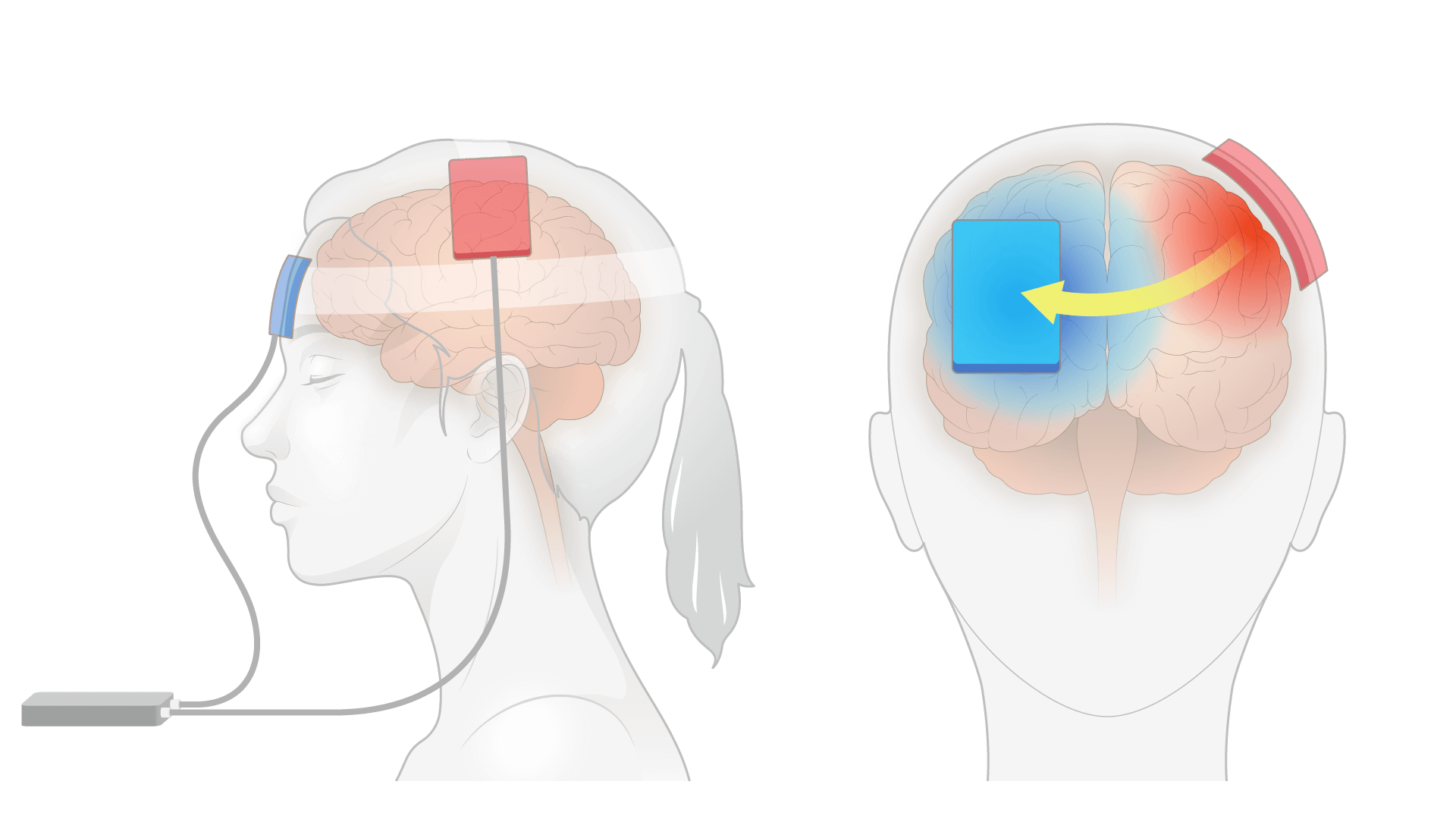 ○Brain Premier tDCS Device 経頭蓋磁気刺激 【公式通販】