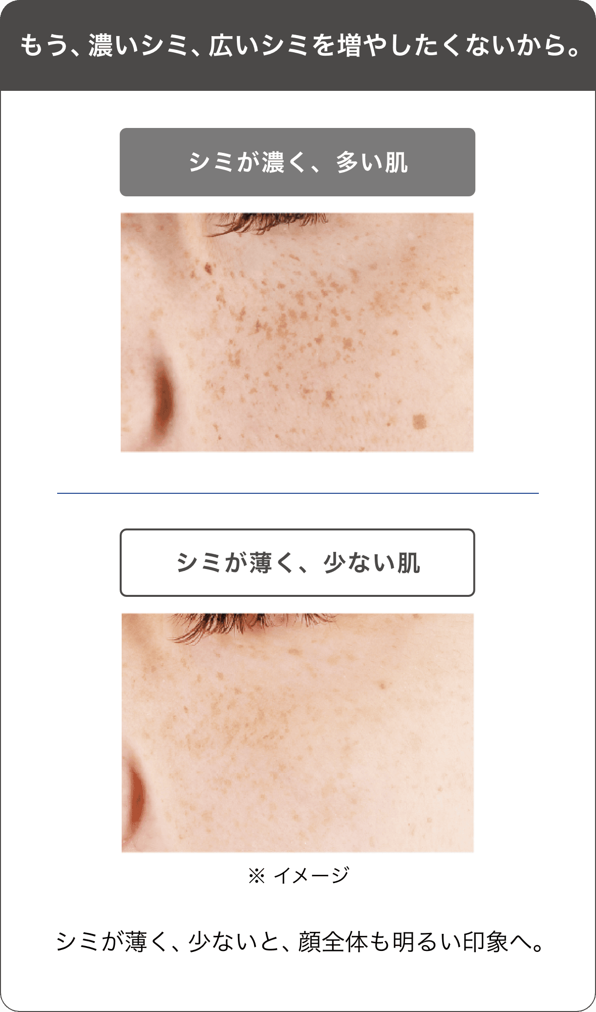 ONE BY KOSE メラノショット W