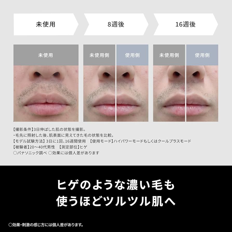Amazon.co.jp: 【冷却機能付】パナソニック 脱毛器 光美容器 光エステ