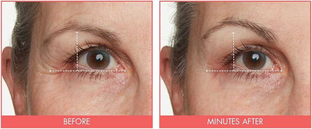 Amazon.com: GENIE Instant Line Smoother (30 ml/1 fl oz) : Beauty