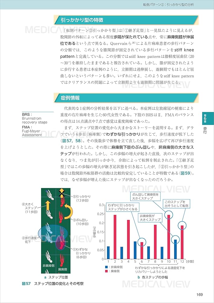 脳卒中片麻痺の基本動作分析−バイオメカニクスから考える動作パターン