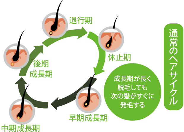 男性の薄毛治療｜ナチュラルAGAクリニック