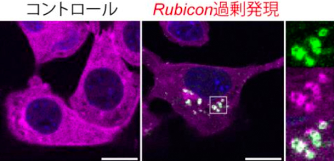 細胞老化を促進するエクソソーム産生メカニズムを解明 - ResOU