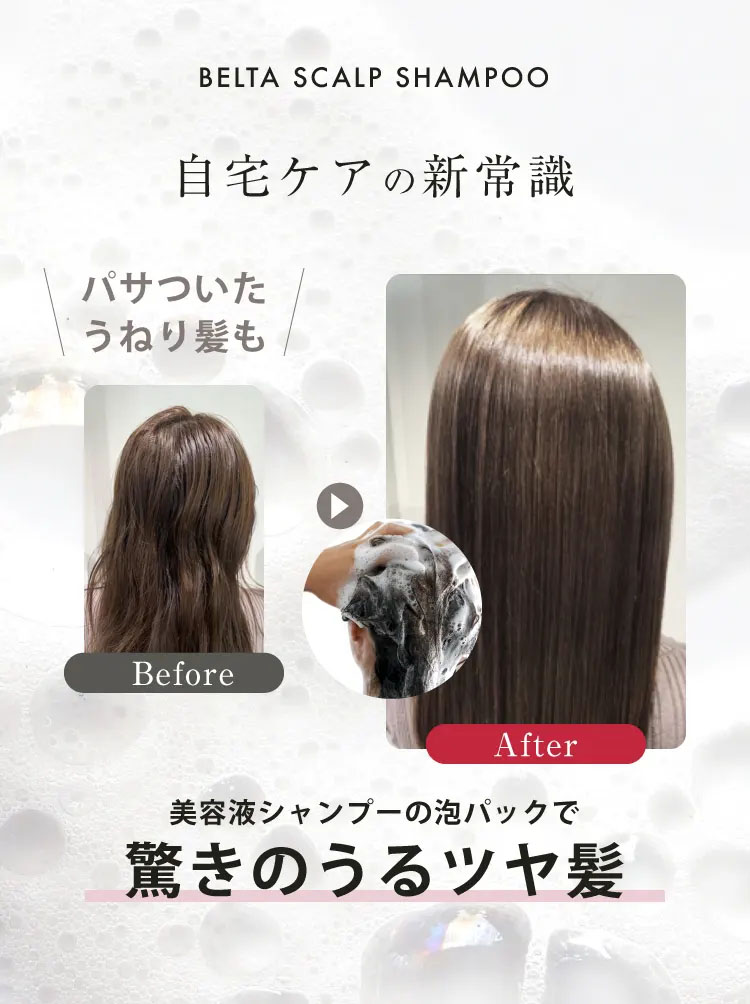 ベルタ（BELTA） シャンプー 女性 ベルタスカルプシャンプー 無添加