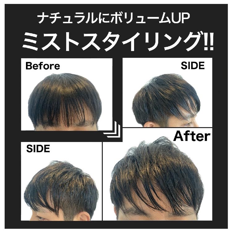 スーパーミリオンヘアー ミストセット ダークブラウン ( 1セット