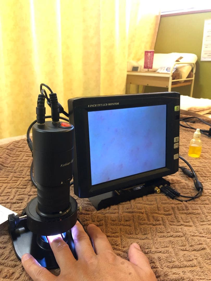 血管美人　マーキュレーター