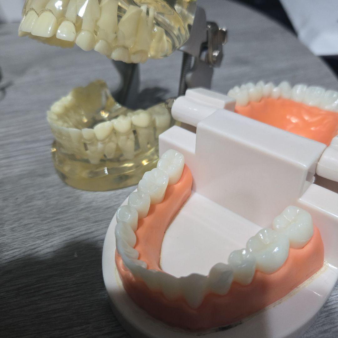 2個 歯列模型 実物大 開閉式 乳歯期 永久歯萌出前 永久歯 交換期 模型