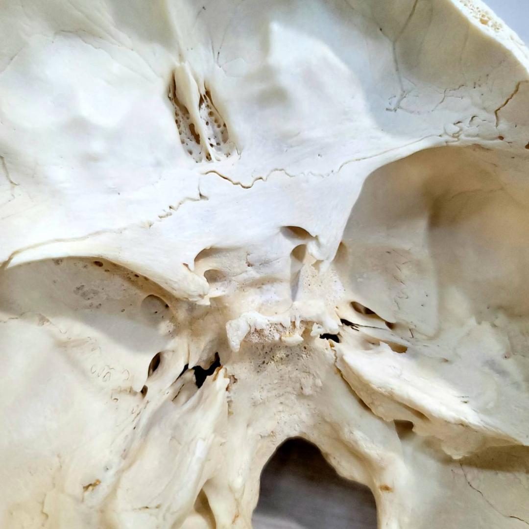 頭蓋骨 頭骨 骨格標本 人体模型 医療 医学 人類学 民俗学 アンティーク